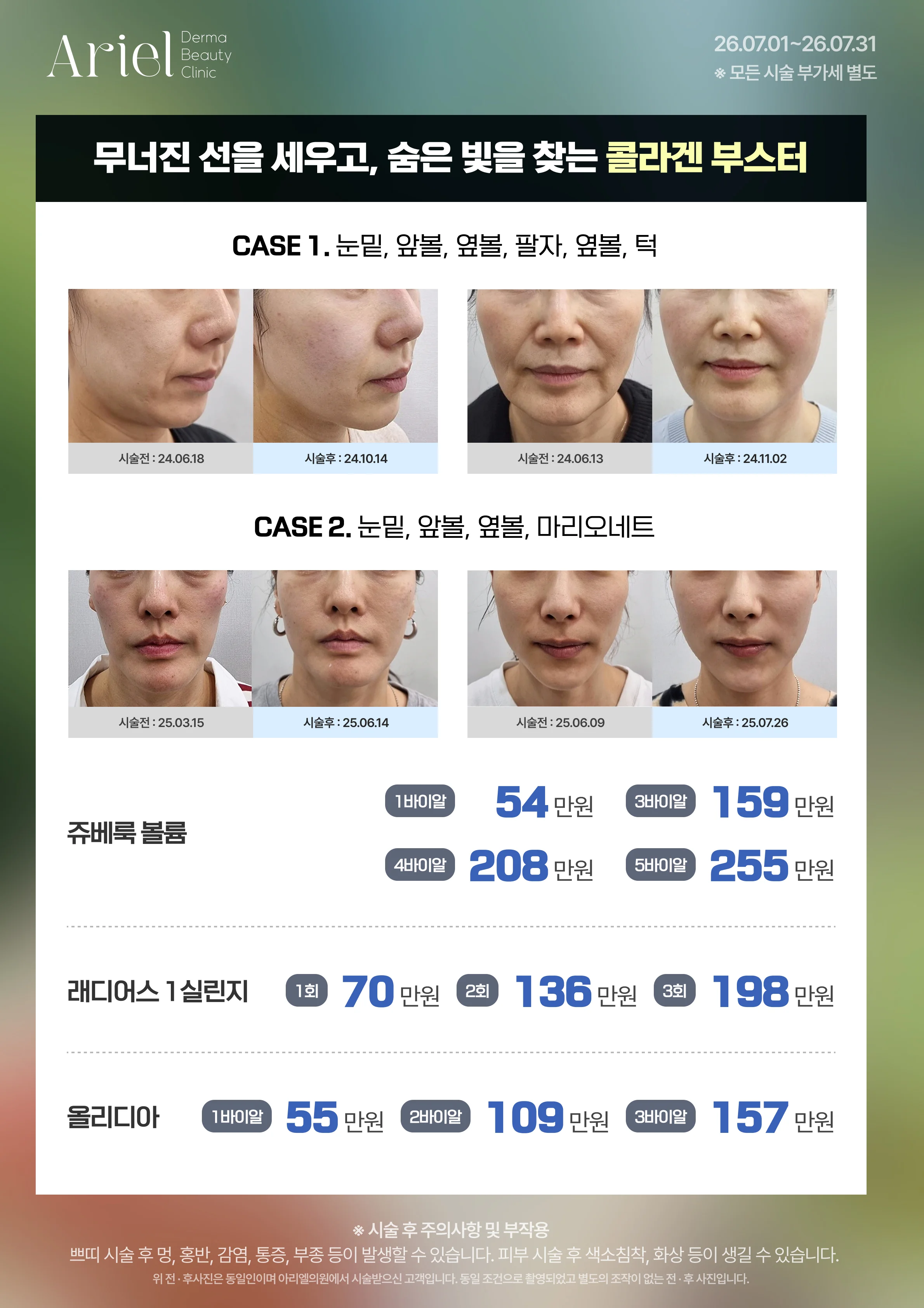 7월 이벤트 — 무너진 선을 세우는 콜라겐 부스터 (쥬베룩 볼륨 1바이알 54만원, 래디어스 1실린지 70만원, 올리디아 1바이알 55만원)