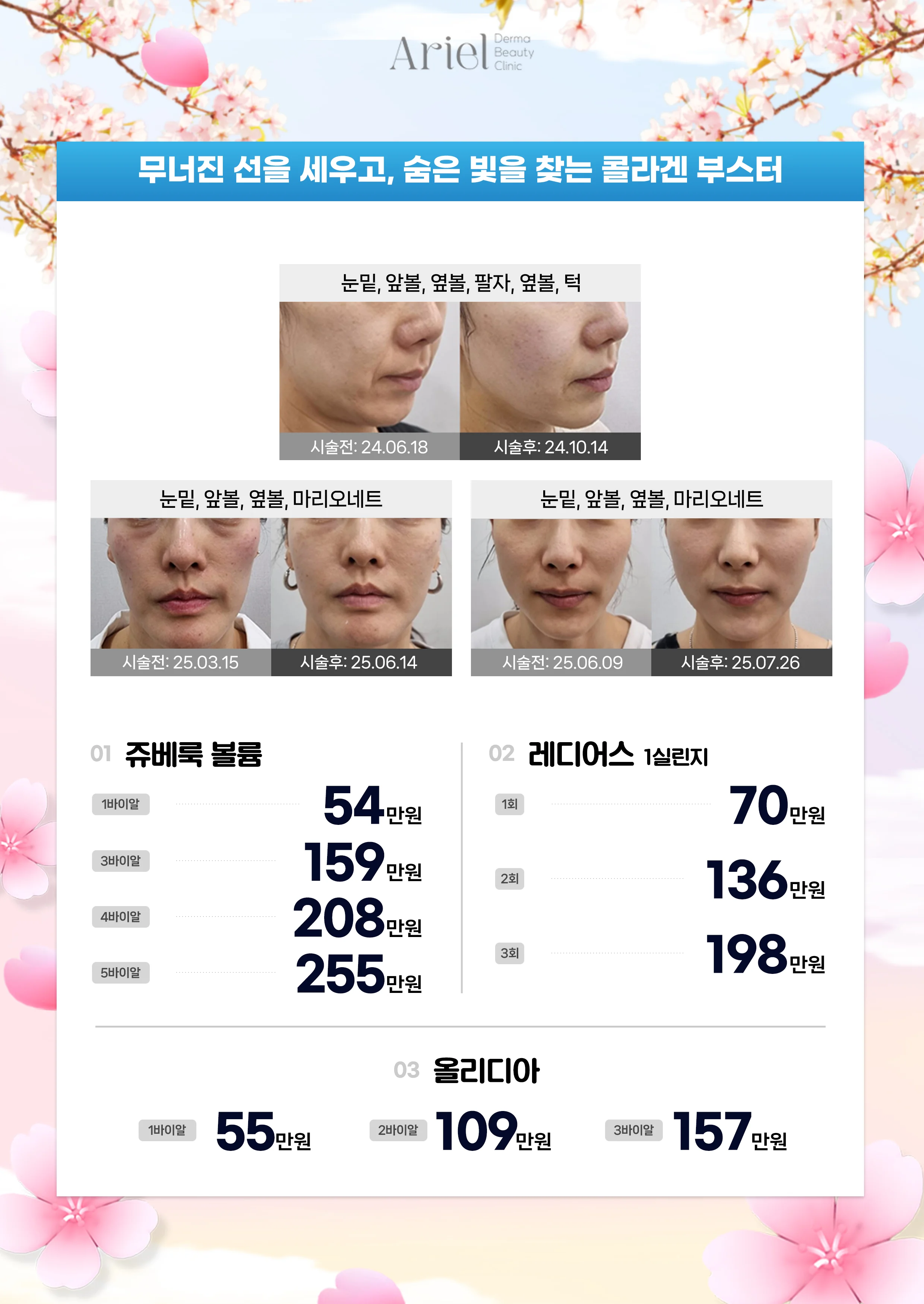 5월 이벤트 — 콜라겐 부스터 (쥬베룩 볼륨/레디어스/올리디아)