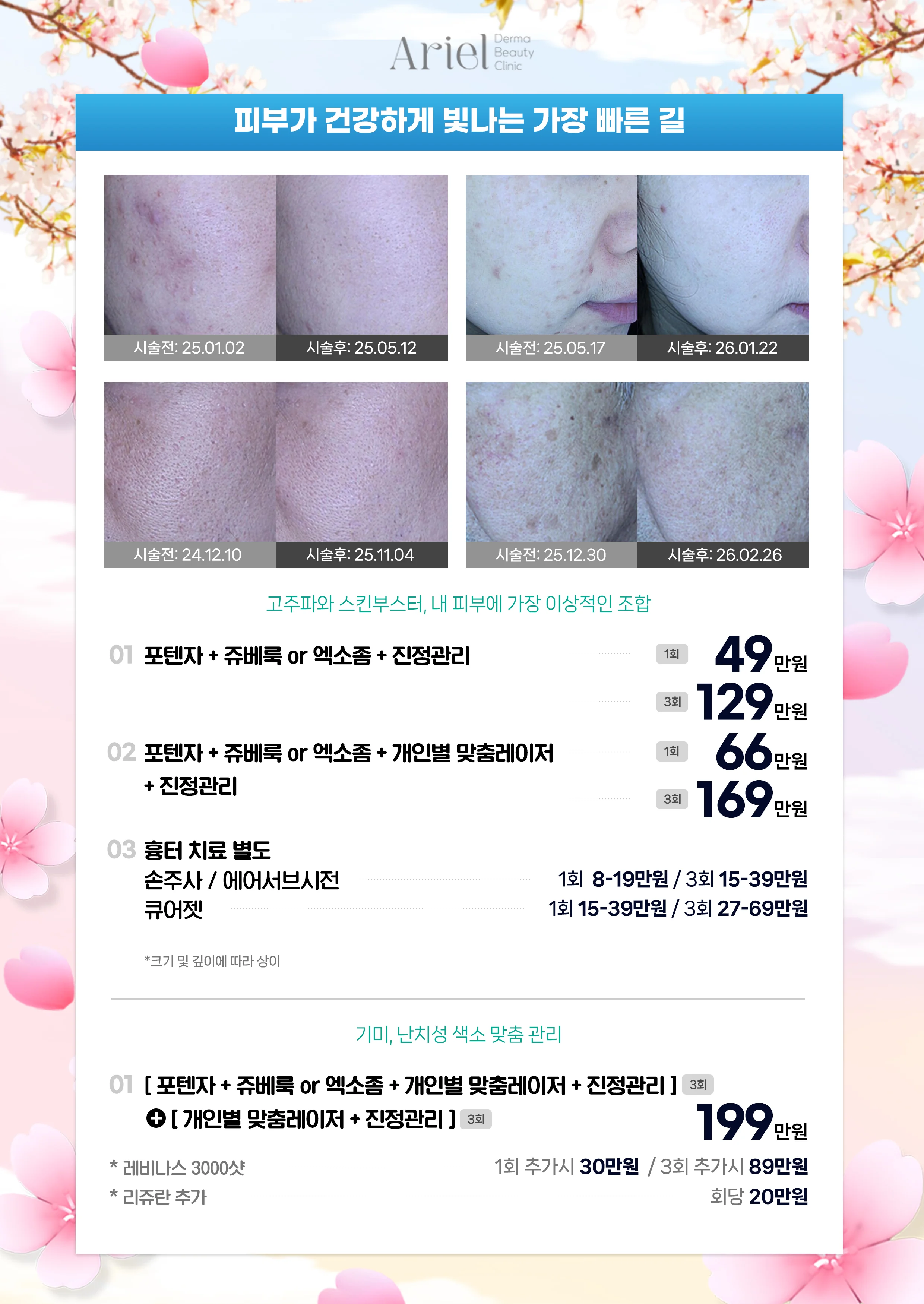 5월 이벤트 — 기미·난치성 색소 맞춤 관리